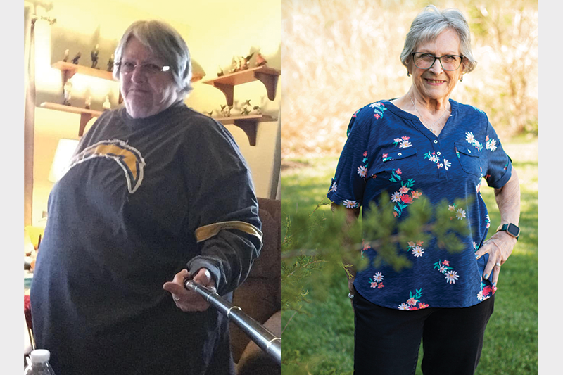 a before and after bariatric surgery photo of successful eldery patient debbi
