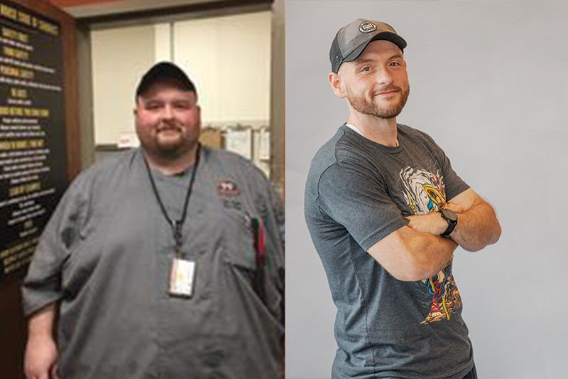 Pete Smith had a successful weight loss transformation with KC Bariatric