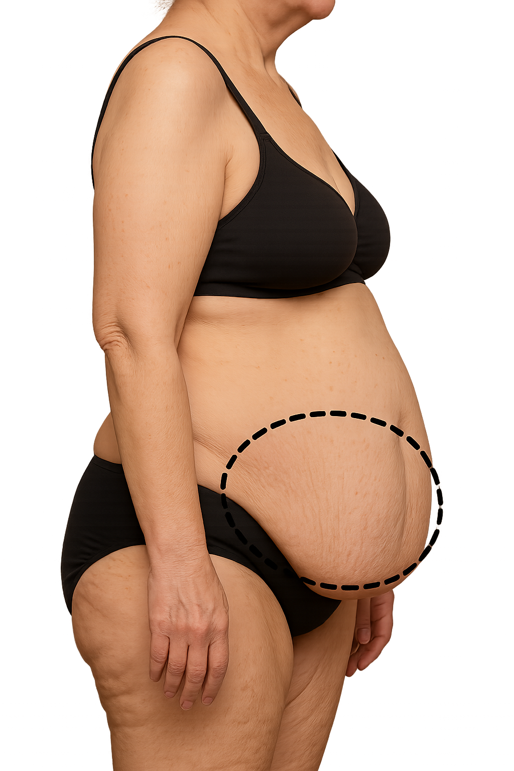 Body contouring image