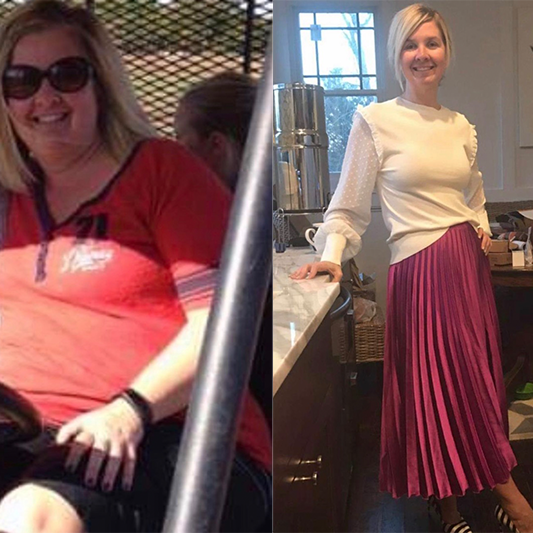 Becky went to KC Bariatric and got her life back on track after being overweight